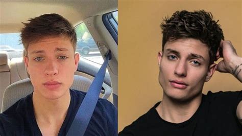 matt rife before and after plastic surgery|Matt Rife Explains Changing Appearance Amid Plastic Surgery。